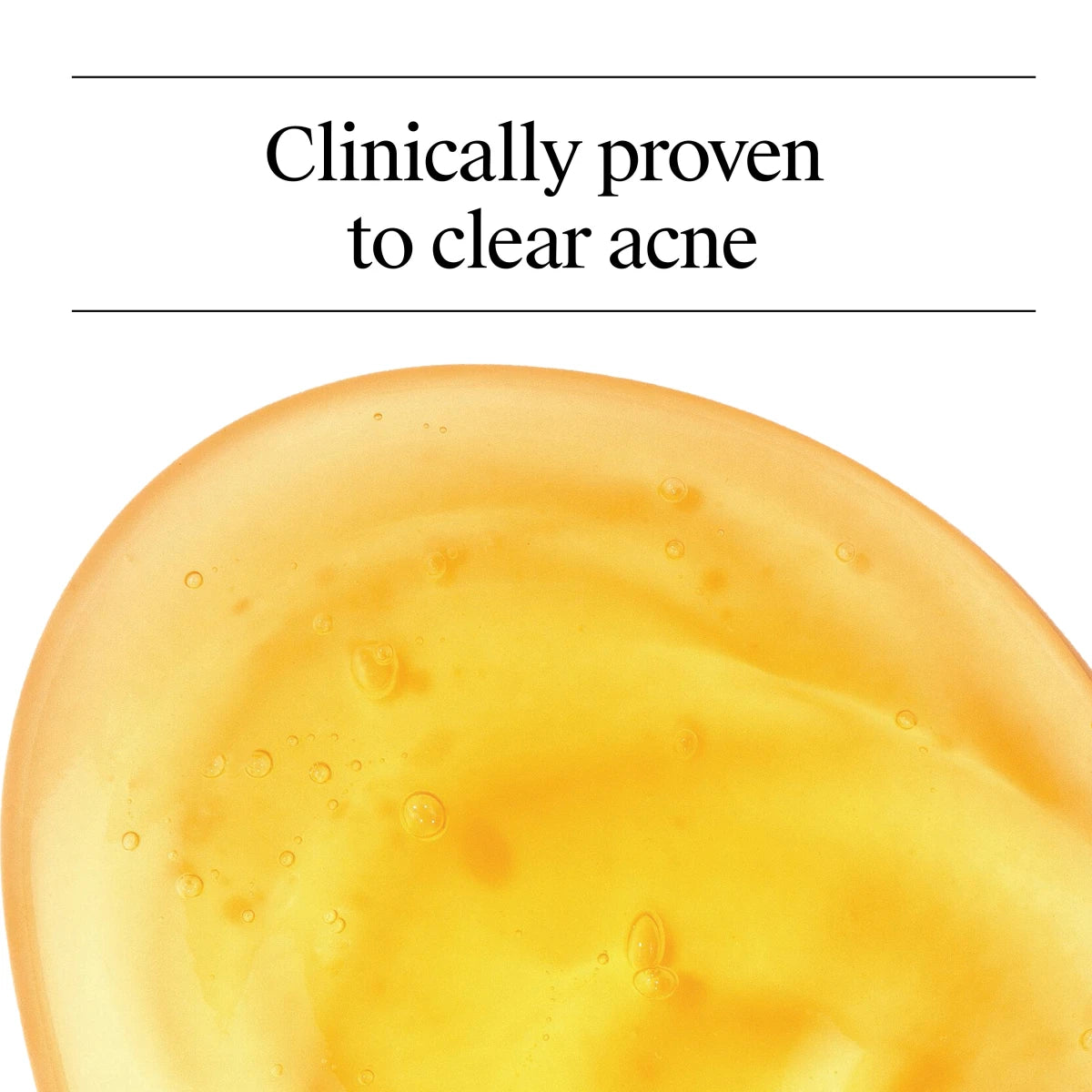 Neutrogena® Oil Free Acne Wash 16 Fl Oz - US 1375