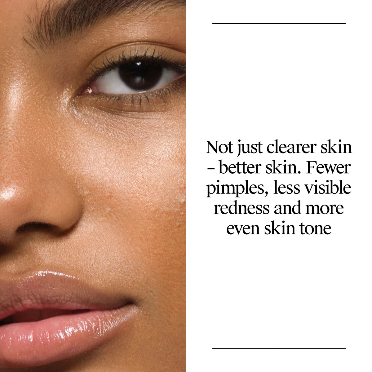 Neutrogena® Oil Free Acne Wash 16 Fl Oz - US 1375