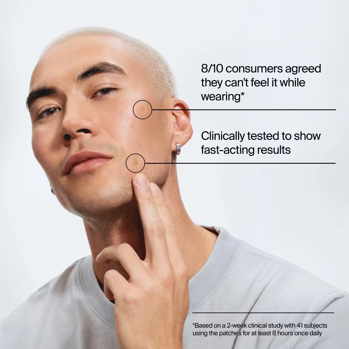 Neutrogena® Stubborn Acne Ultra-Thin Blemish Patches, Combination Pack, 24 Patches - US 4885