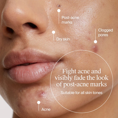 Neutrogena® Evenly Clear™ Acne Gel Moisturizer, 1.7oz - US 0712